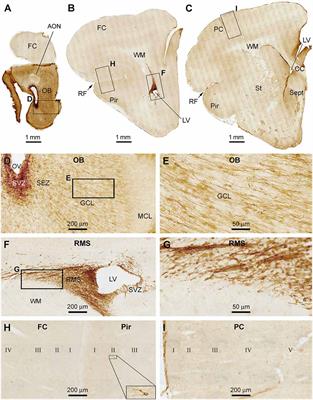 Doublecortin-Expressing Neurons in Chinese Tree Shrew Forebrain Exhibit Mixed Rodent and Primate-Like Topographic Characteristics